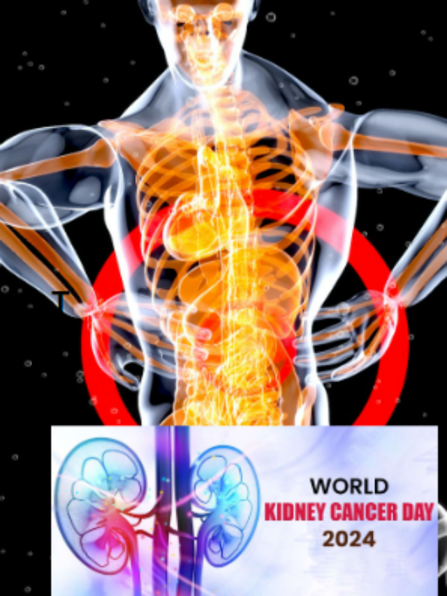 Do you have a symptoms of kidney cancer?  #WorldKidneyCancerDay