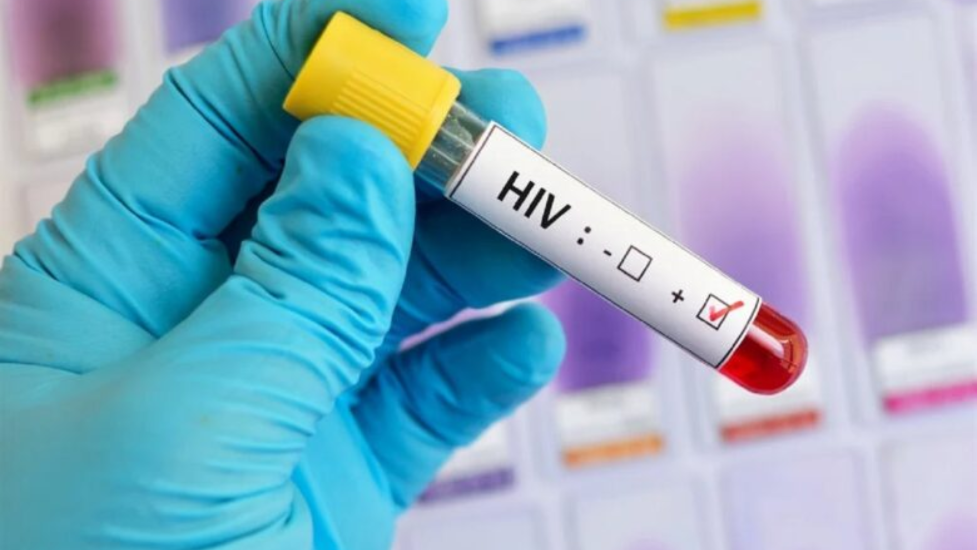 AIDS Conference: New HIV-Prevention Drug Announced To Be A Potential Game Changer