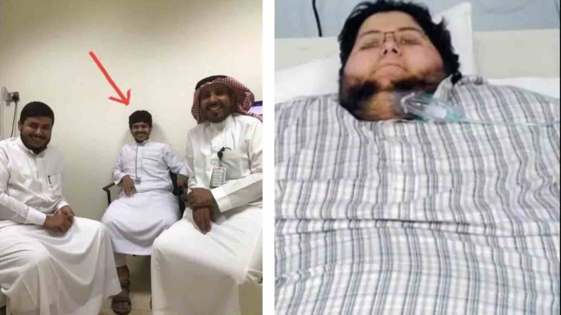 Saudi Man’s Extraordinary 500-Kg Weight Loss: Stunning Transformation