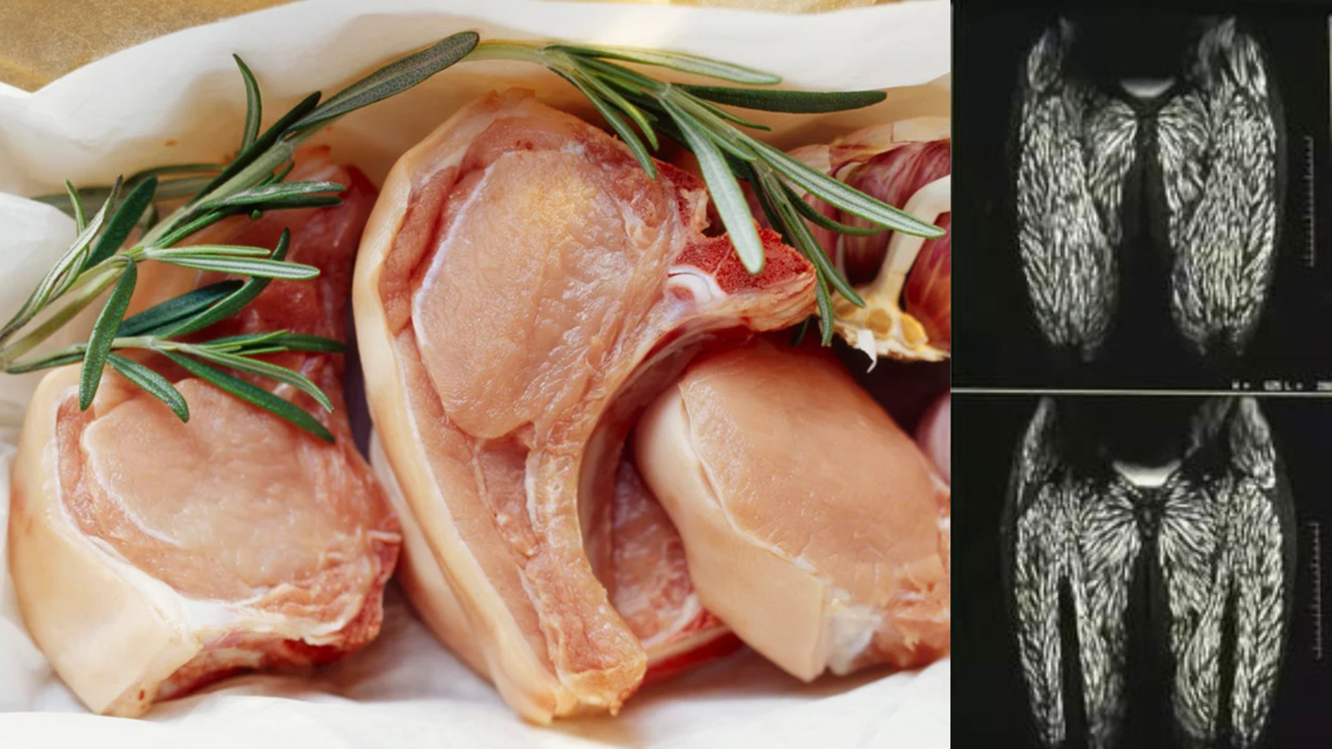 Scan Reveals A Girls Body Riddled With Parasites After Eating Raw Pork For 10 Years