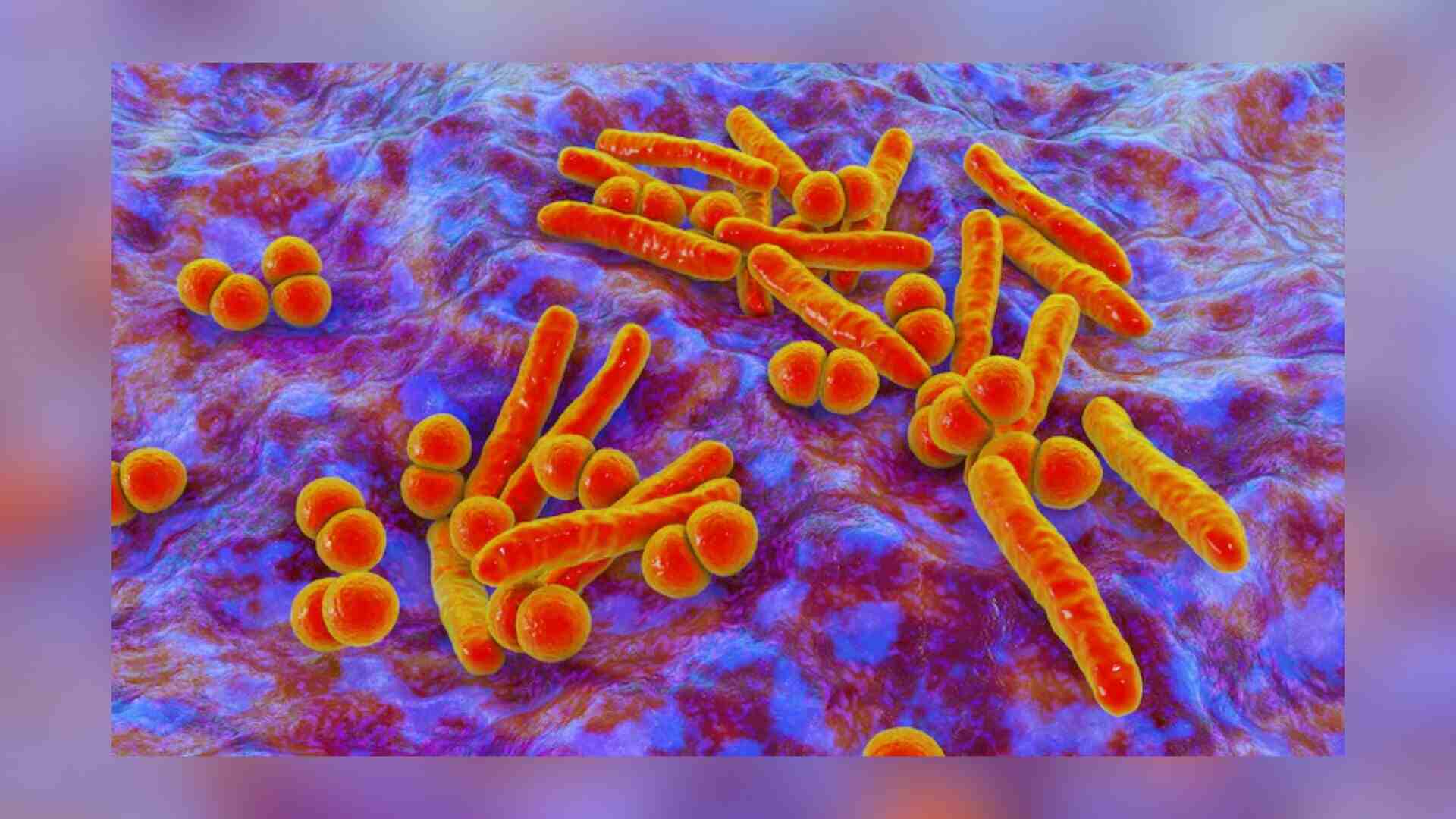 Harvard Study: TB Strain’s Geographic Roots Affect Infection Rates