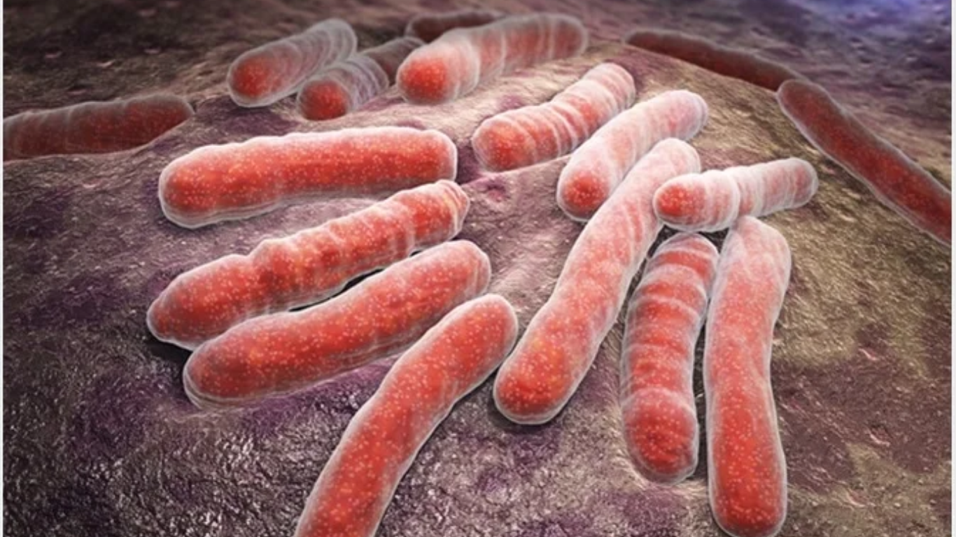 Study Shows TB Infection Risk Depends on Human and Bacterium Sharing Hometown