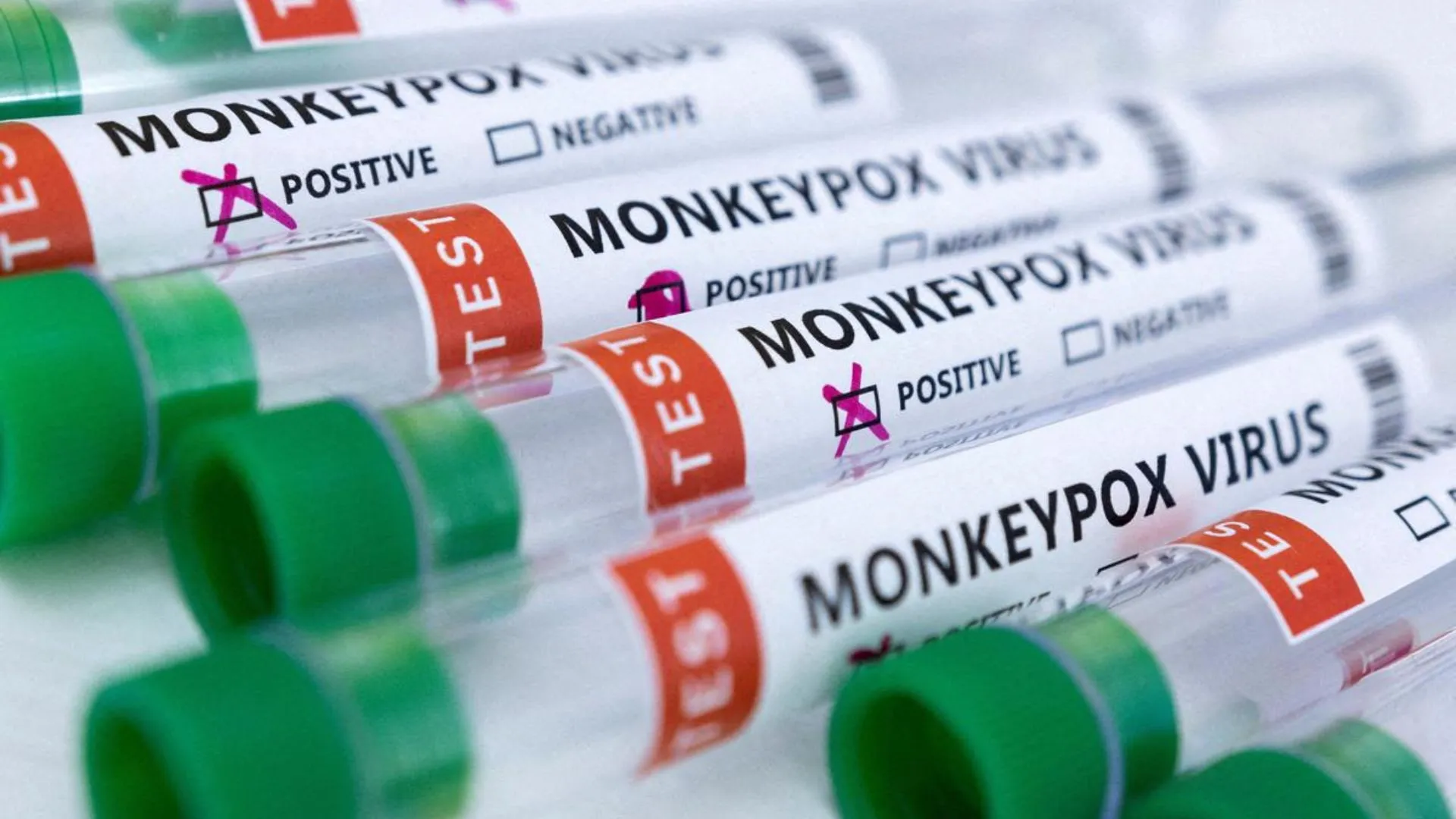 Another Monkeypox Case Reported, 38 Year Old Man Diagnosed