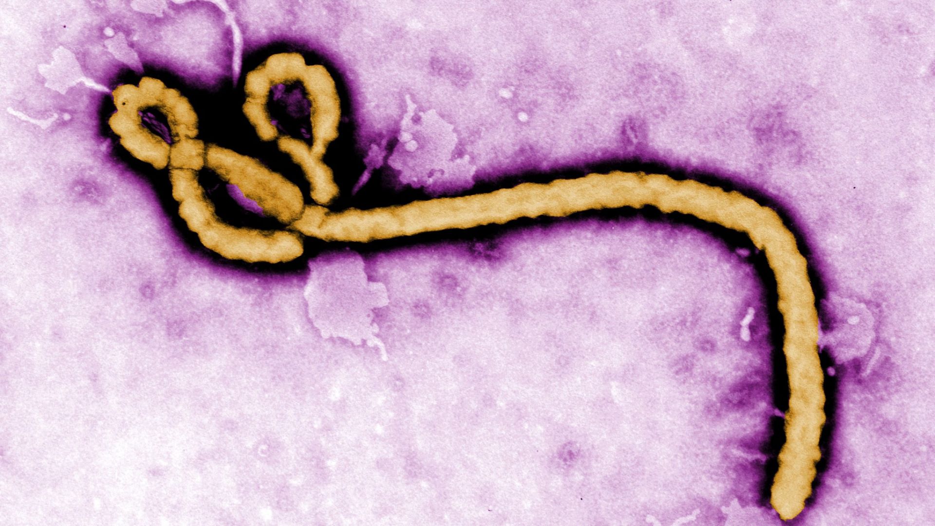 CDC To Begin Testing Travelers From Rwanda For Ebola-Like Illness