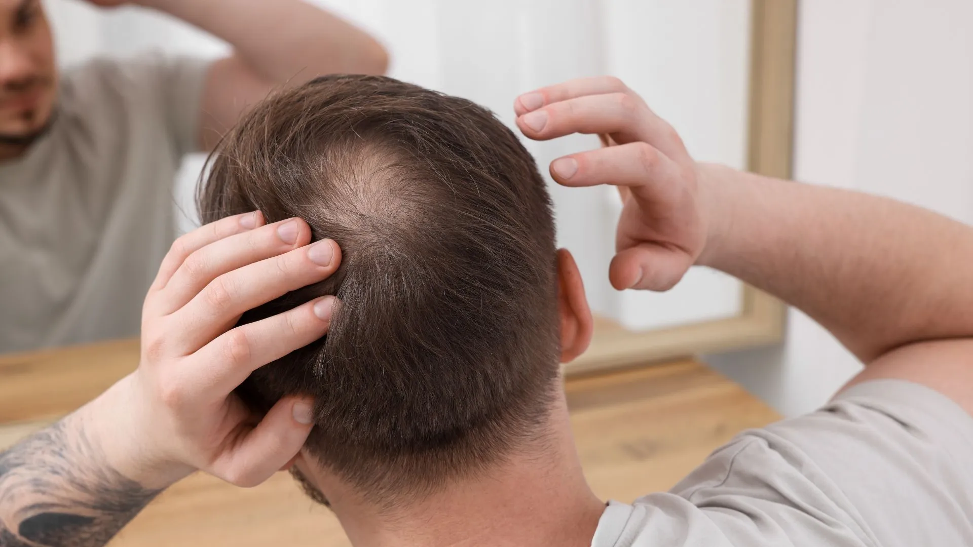 Dealing With Hair Loss In Your 30s? Know Causes, Treatments, And Prevention Tips