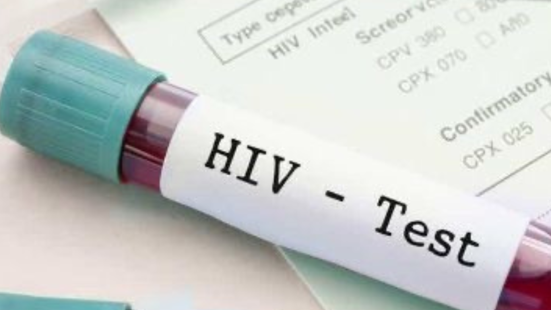 HIV Cases and Deaths Are Declining Globally, Lancet HIV Research Says