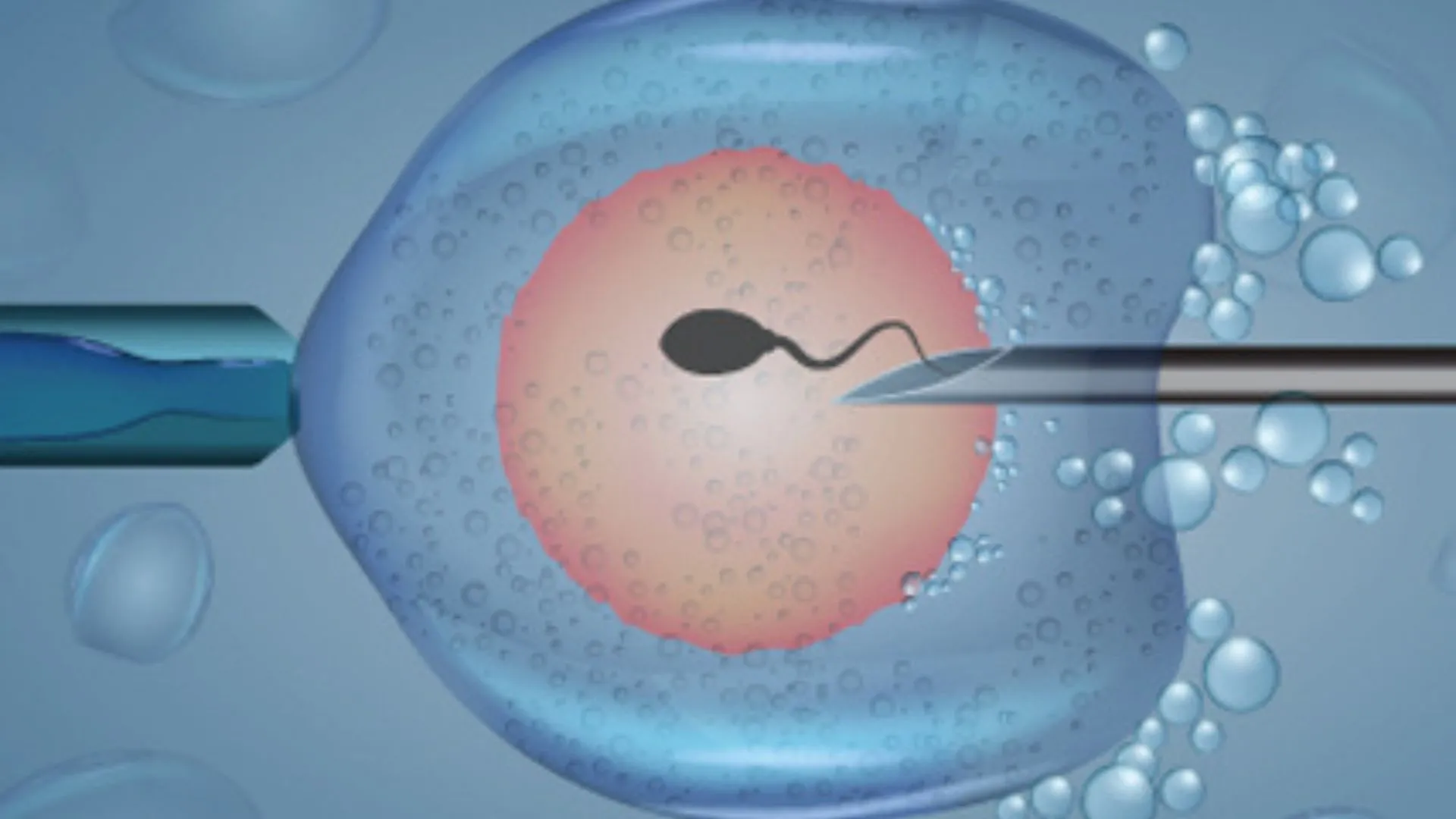 Surge In IVF Treatment Among Single Women And Same-Sex Couples, Report Reveals