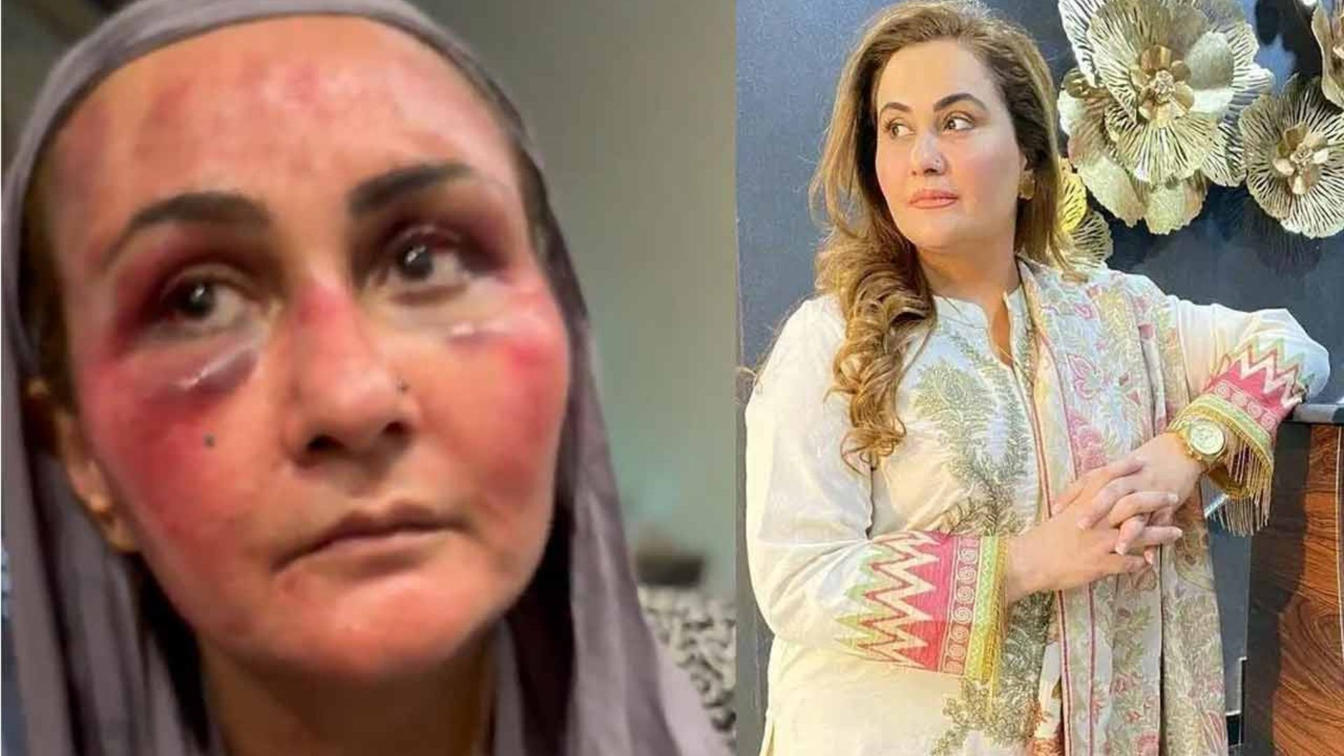 Hit and Dragged: Pakistani actress Alleges Brutal Abuse By Husband