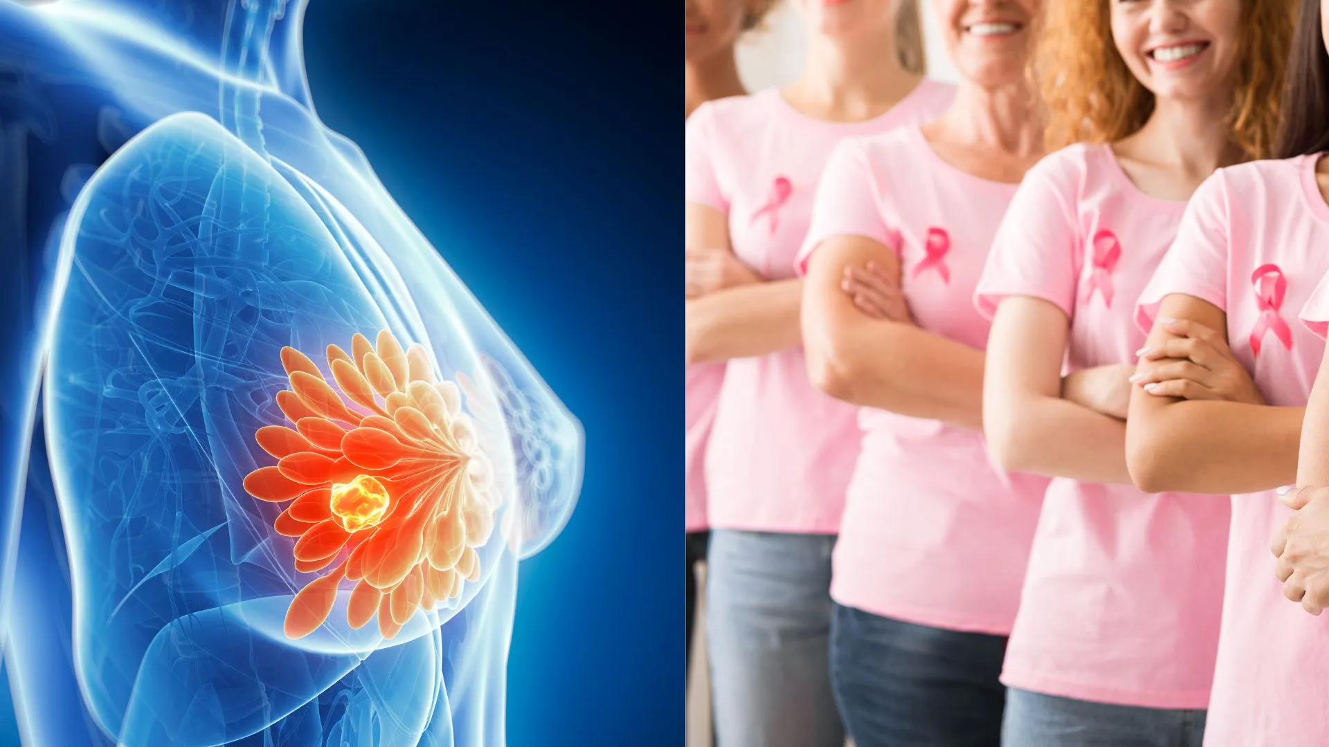 How To Spot Breast Cancer Early: 4 Signs To Watch Out for In Your 20s, 30s, And 40s