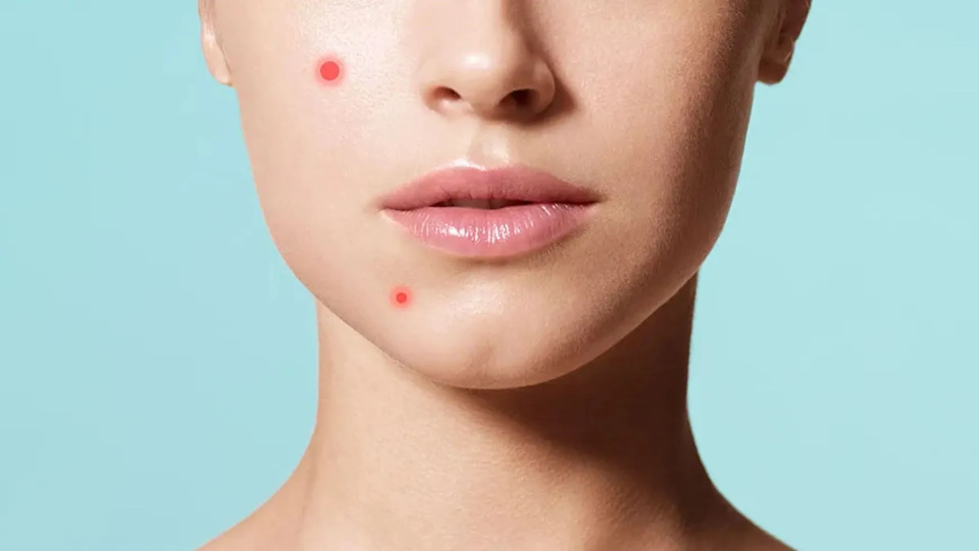 When Simple Pimple Turns Into Skin Cancer: A Wake-Up Call