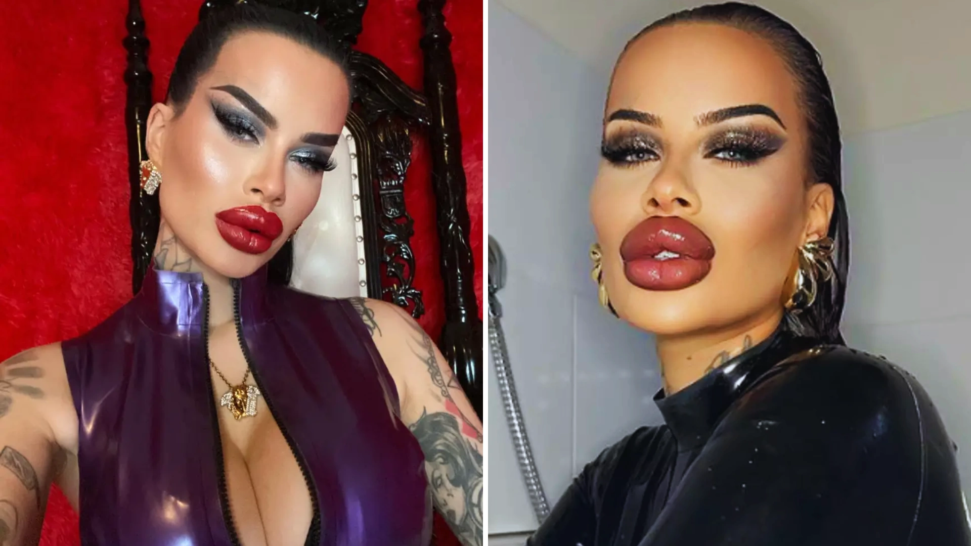 Austrian OnlyFans Model Fetish Barbie Shells Out £50,000 To Get Drastically Plumped Lips: I’m Obsessed With Plastic Surgery