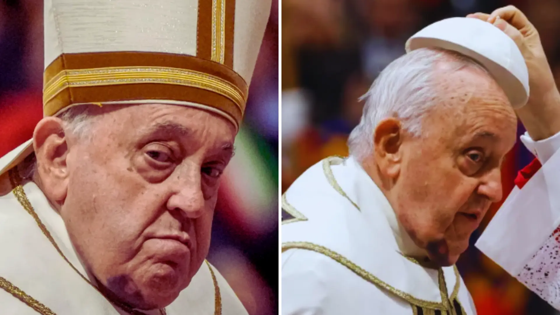 What Happened To Pope Francis? Catholic Church Head Sparks Health Concerns With Black Bruise On Chin And Swollen Neck