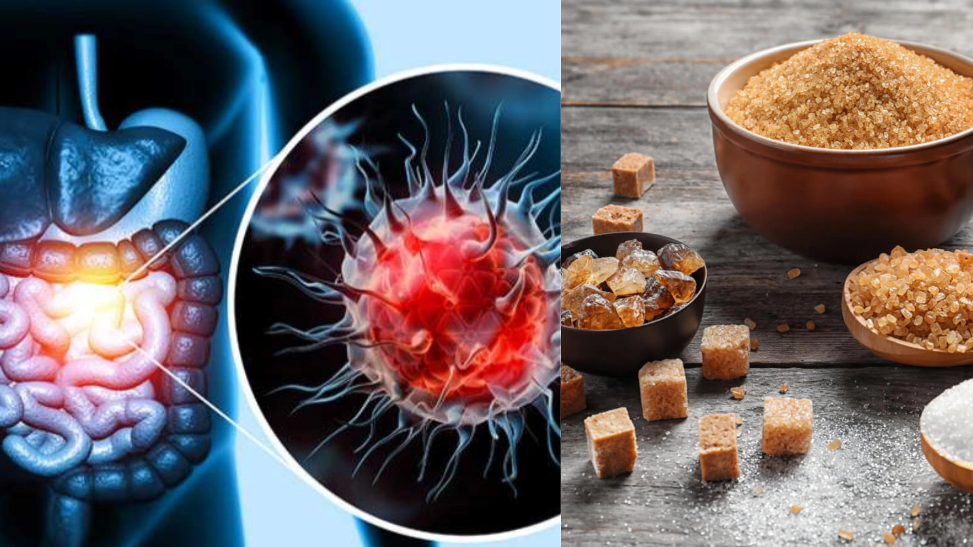 Dietician Reveals ‘Only Two Foods’ Causes Cancer, ‘Sugar is Not One Of Them’