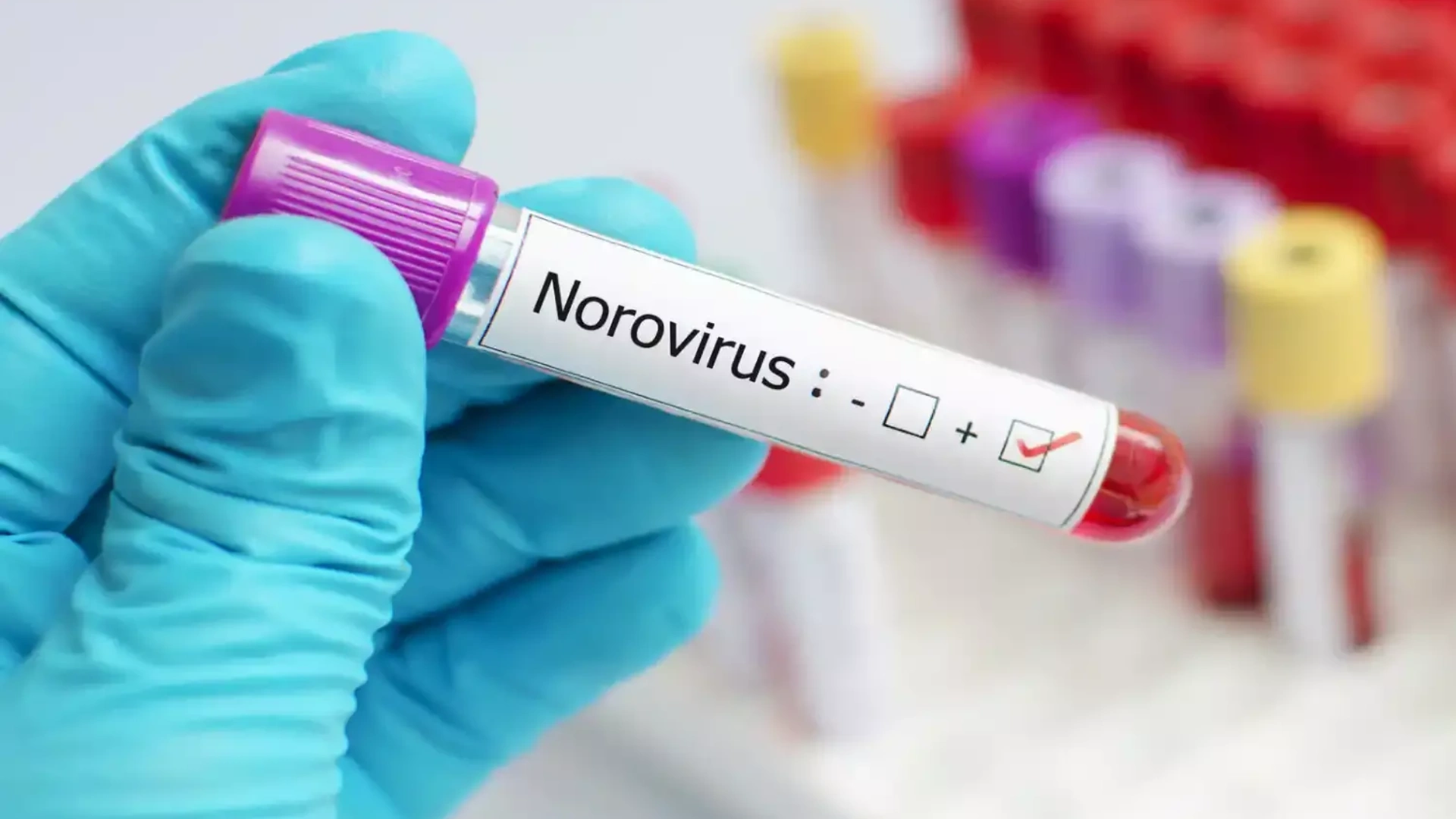 Norovirus Cases On Rise In US: Here’s What You Need To Know