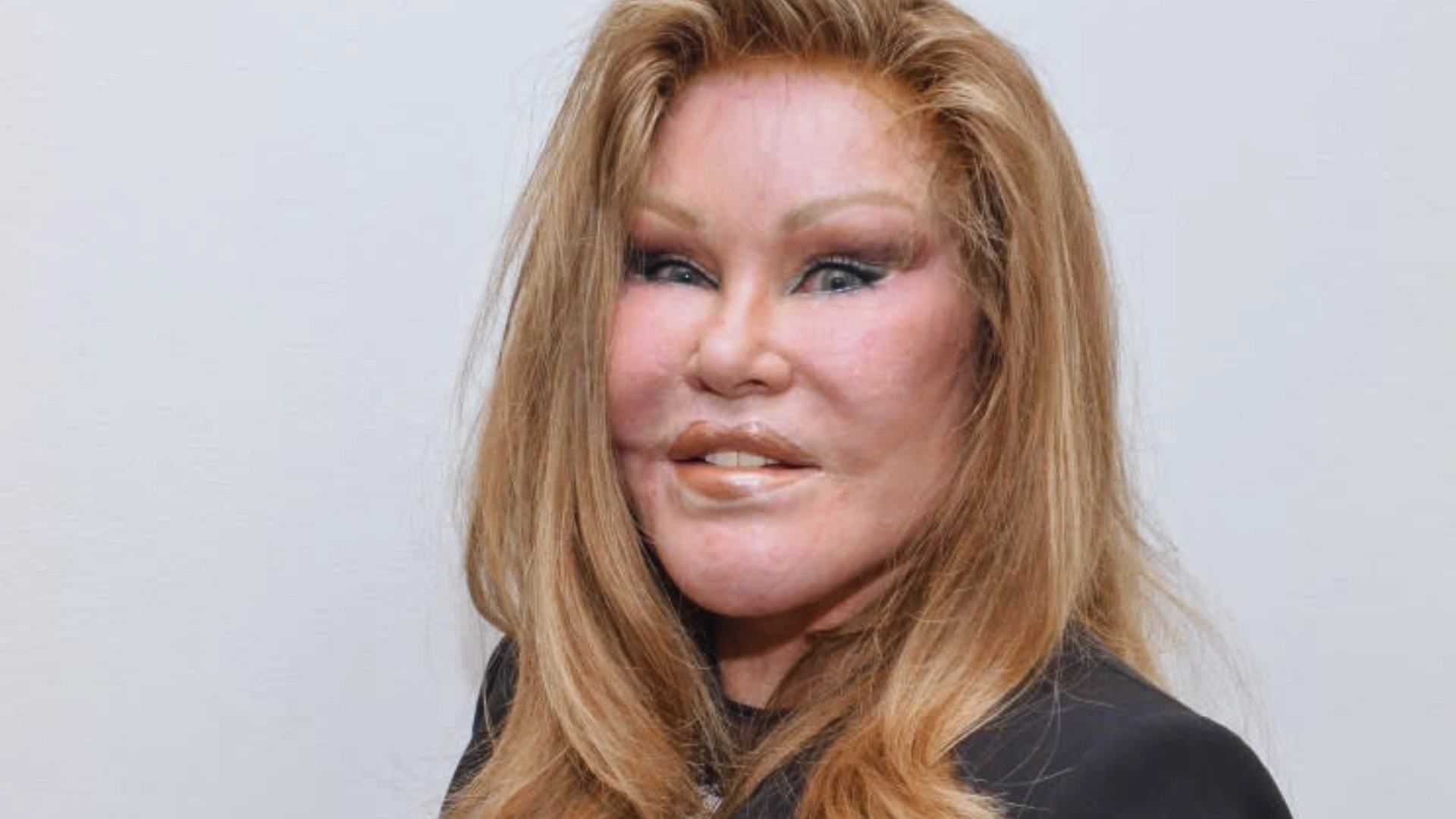 Swiss Socialite Jocelyn Wildenstein Was Once Arrested For Slashing Her Boyfriend With Scissors, Also Caught Husband With A Hot Russian Model