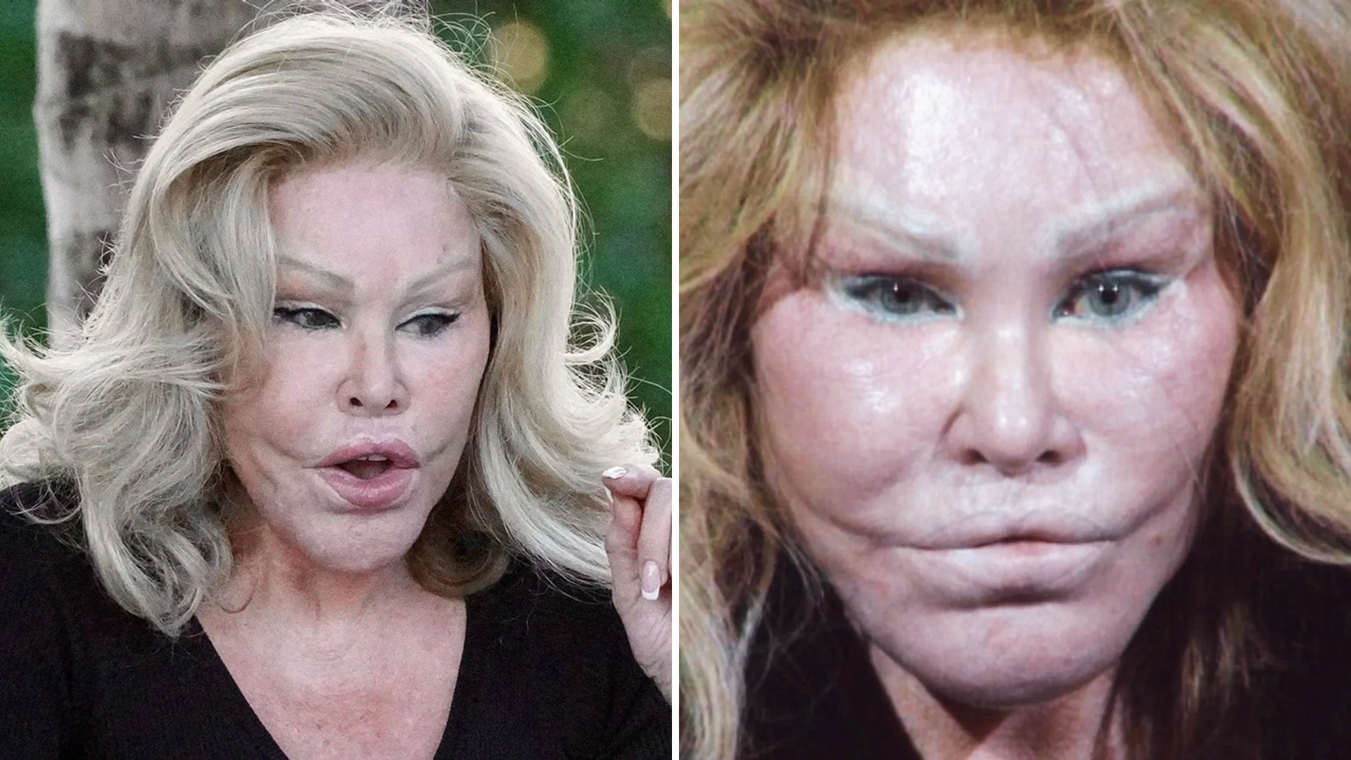 Who Was Jocelyn Wildenstein? Catwoman, Who Always Denied Her Plastic Surgery Addiction, Dies At 84